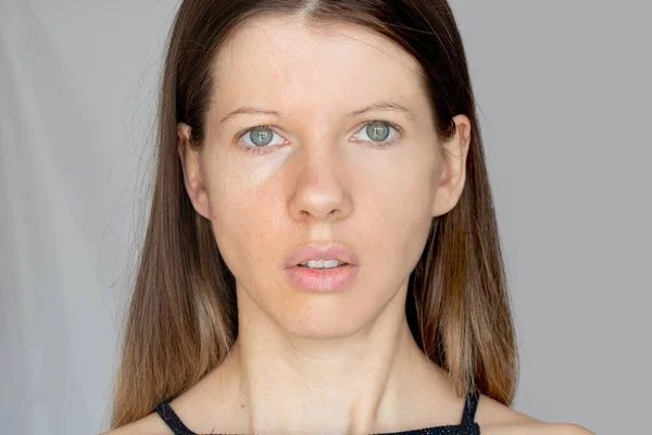 Ansiktet Ung Flicka Uppdelad Två Halvor Med Och Utan Ansikte — Stockfoto