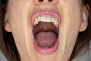 Dişi ağzını aç, ağzını ve dilini kapat.