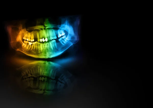 Χρώμα ακτινογραφία δοντιών γνάθου ανθρώπινο κρανίο. πανοραμική φωτογραφία αρνητική εικόνα του στόμα νεαρά ενήλικα αρσενικά. ιατρική σχεδιασμός στοιχείο δείγμα κενό πρότυπο οριζόντια χαρτί μεγέθους Α4. — Φωτογραφία Αρχείου