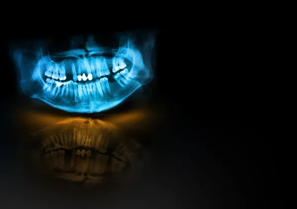 Crânio de mandíbula de dentes de raios X azul com brilho laranja, sombra e reflexão sobre fundo preto. Imagem Panorâmica negativa do homem facial. Modelo de amostra de elemento de design médico modelo em branco tamanho de papel horizontal A4 — Fotografia de Stock