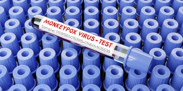 Monkey pox virus blood test vials - 3D illustration