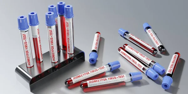 Majom Himlő Vírus Vérvizsgálat Injekciós Üvegek Illusztráció — Stock Fotó