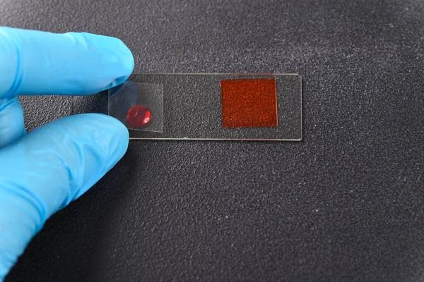 Due Gocce Liquido Rosso Sul Vetrino Del Microscopio — Foto Stock