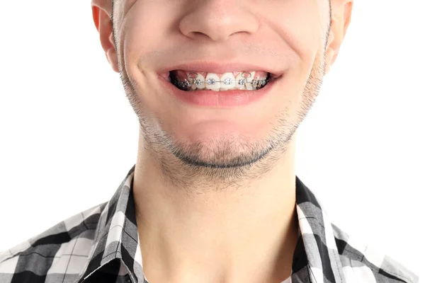 Pria Dengan Kawat Gigi Terisolasi Pada Latar Belakang Putih Tutup — Stok Foto