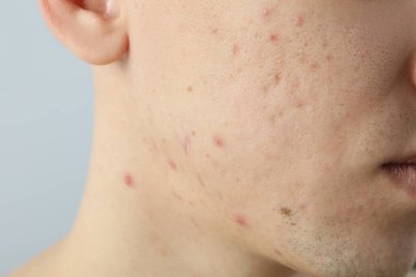 Cilt bakımı ve cilt bakımı kavramı