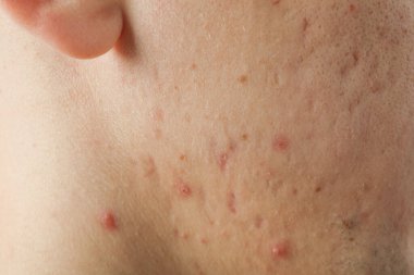 Cilt bakımı ve cilt bakımı kavramı