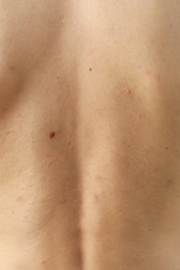 Genç adamın sırtında vücut bakımı kavramı