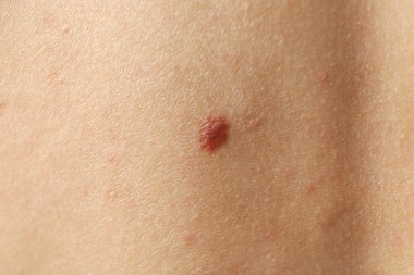 Benli cilt ve vücut bakımı kavramı