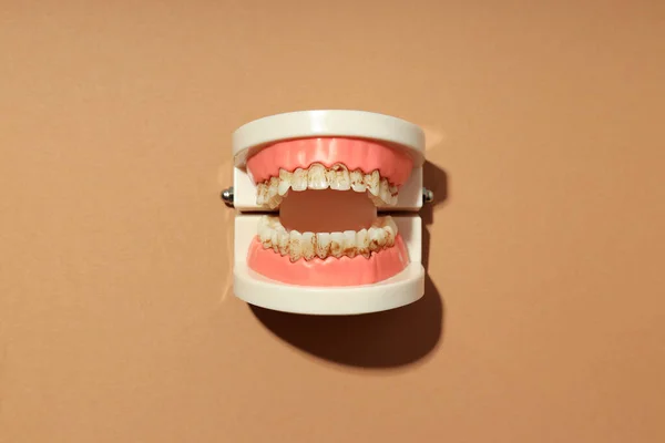 Concept Tooth Care Jaws Light Brown Background — Foto de Stock