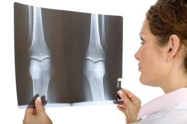 Doktor Röntgen arayan kadın