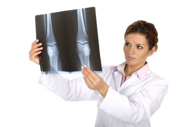 Doktor Röntgen arayan kadın