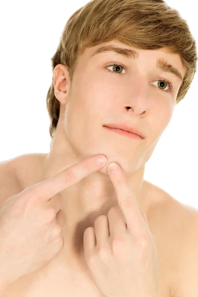 Man picking at acne — Stock Photo, Image