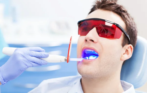 Ультрафиолетовое оборудование стоматолога — стоковое фото