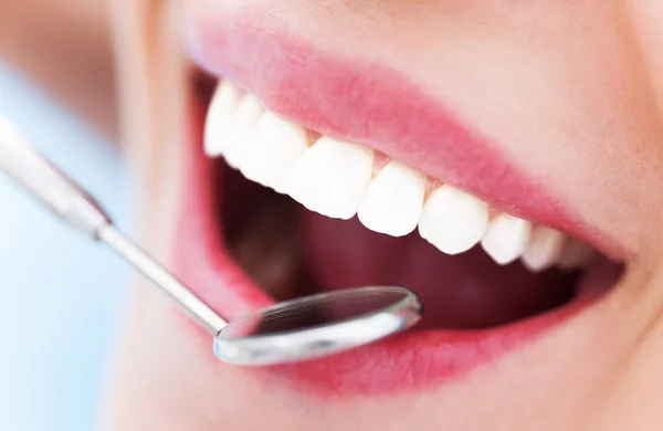 Woman teeth and a dentist mouth mirror — Stock Photo, Image