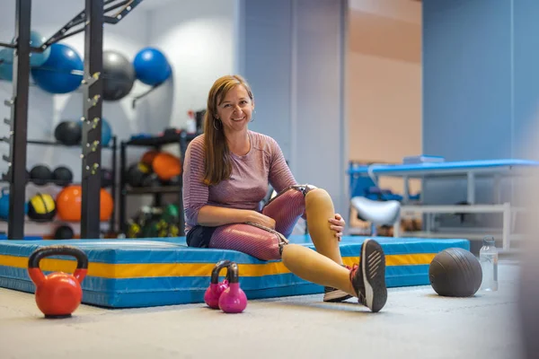 Junge Frau Mit Beinprothese Beim Training Physiotherapiezentrum — Stockfoto