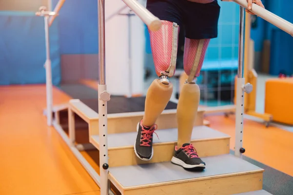 Protez Bacaklı Genç Bir Kadın Fizyoterapi Merkezinde Egzersiz Yapıyor — Stok fotoğraf