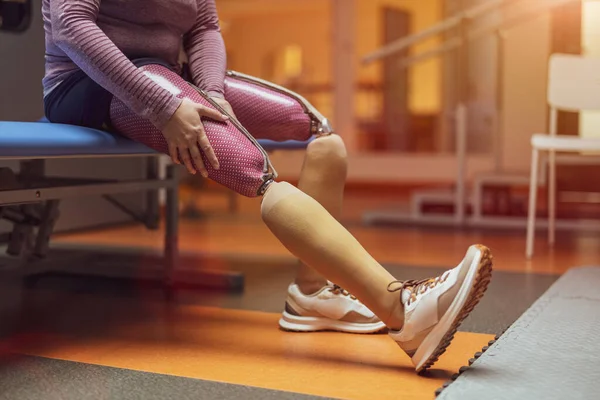 Jeune Femme Avec Des Jambes Prothétiques Faisant Exercice Centre Physiothérapie — Photo