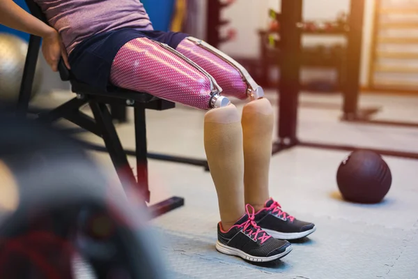 Jonge Vrouw Met Prothetische Benen Die Traint Het Fysiotherapie Centrum Rechtenvrije Stockfoto's