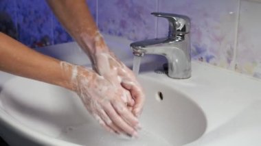 Vitiligo hastalığı genç bir kızın ellerinde. Deri bölgelerinde depigmentasyon. Banyoda ellerini yıkayan bir kızın yakın çekimi. Vitiligo dermatoloji sorunu olan bir kadın konsepti.