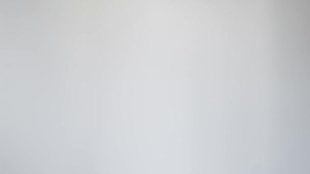 Gros Plan Main Une Fille Avec Vitiligo Montre Majeur Sur — Video