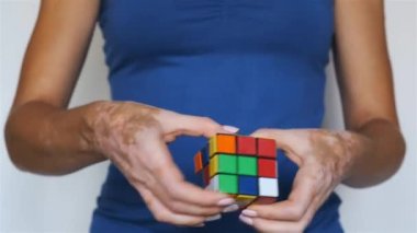 Deri hastalığı olan bir kadın çokgen şeklinde bir Rubik küp bulmacasını çözer. Yakın plan..