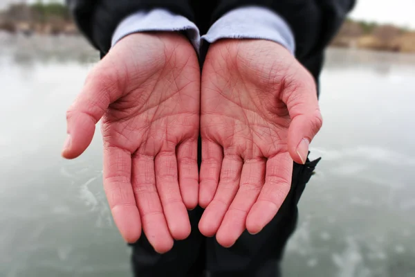 Жіночих рук з хвороба Рейно — стокове фото