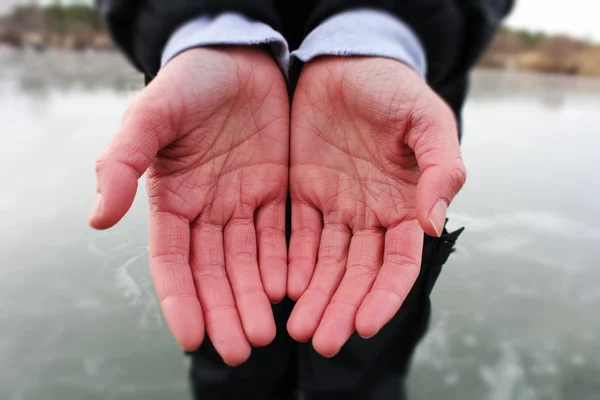 Mãos femininas com doença de Raynaud — Fotografia de Stock