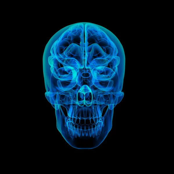 Rayos X del cerebro humano - vista frontal — Foto de Stock