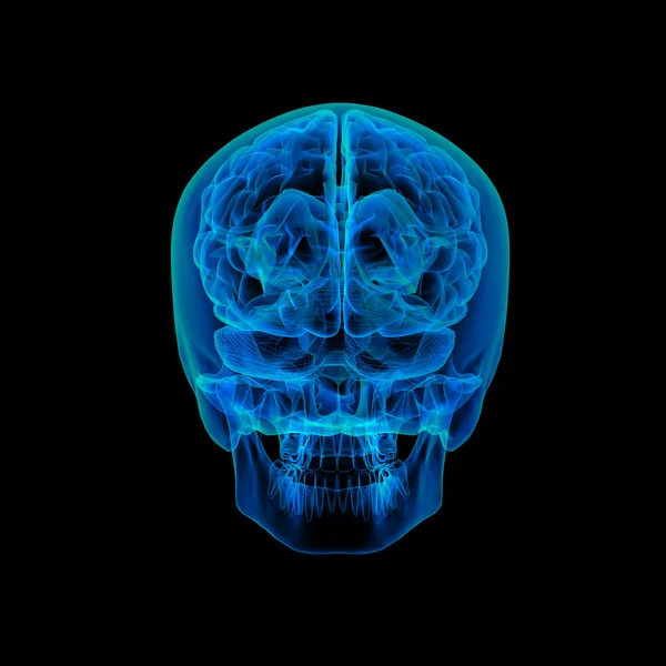 Human brain X ray - back view — Stock Photo, Image