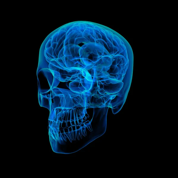 Mänsklig hjärnröntgen - sidovy — Stockfoto