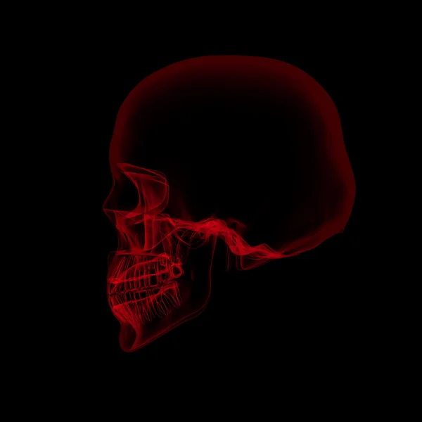 Cranio umano a raggi x su sfondo nero — Foto Stock