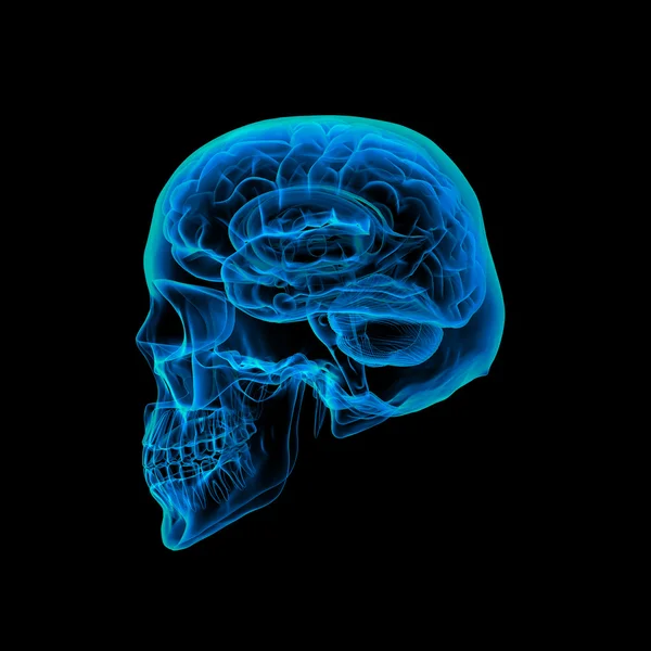 Insan beyin x ışını - kafatası x ışını — Stok fotoğraf