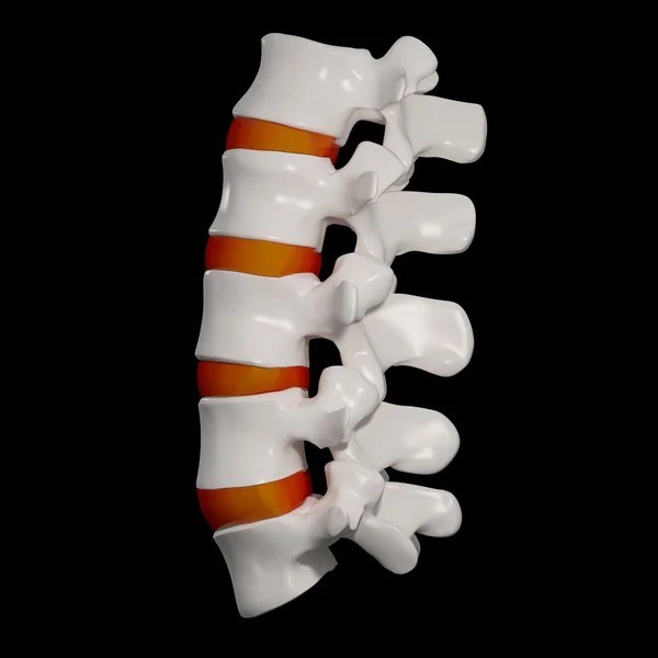 3d renderizado - estructura de la columna vertebral sobre fondo negro con disco espinal rojo - vista lateral —  Fotos de Stock