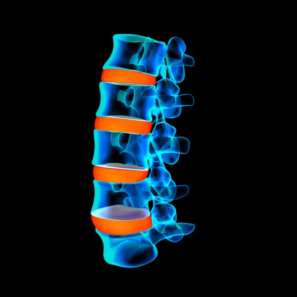 3d renderizado - estructura de la columna vertebral sobre fondo negro con disco espinal rojo - vista lateral — Foto de Stock