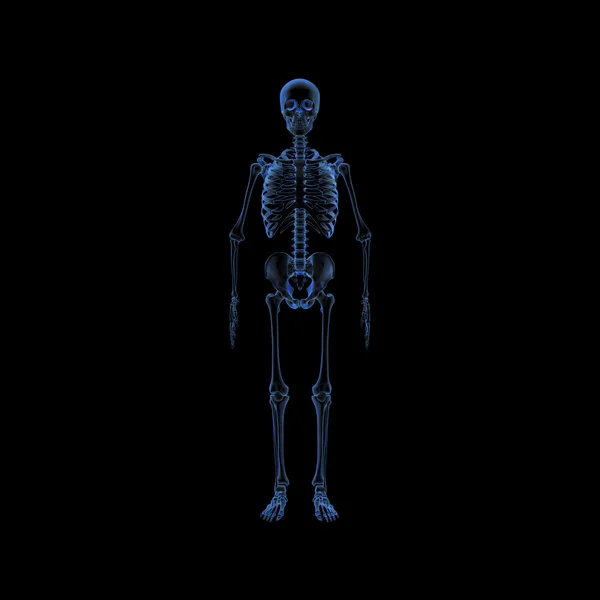 Rayos X de esqueleto —  Fotos de Stock