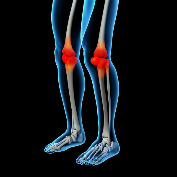 Human knee pain with the anatomy of a skeleton leg