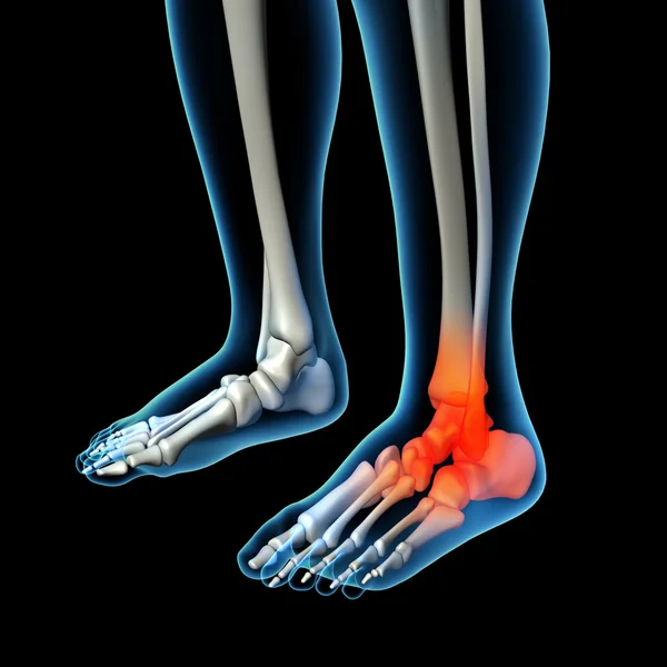 insan ayak ağrısı ile iskelet ayak anatomisi