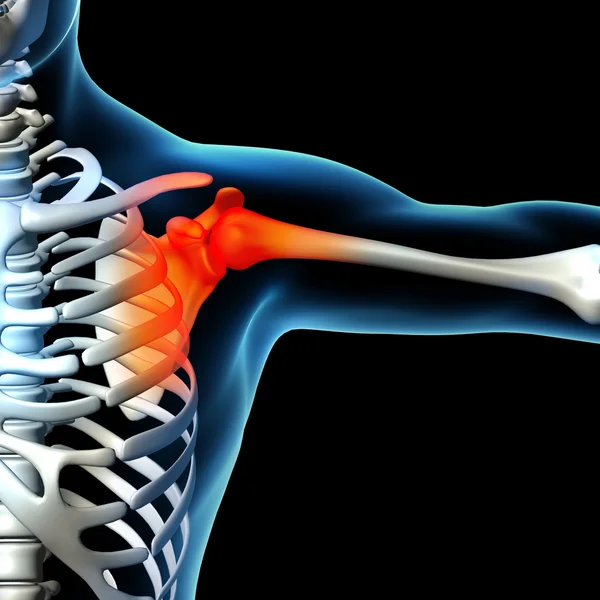 Боль в плече человека с анатомией плеча скелета — стоковое фото