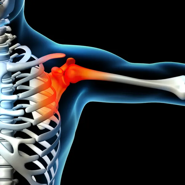 Menselijke Schouderpijn met de anatomie van een skelet schouder — Stockfoto
