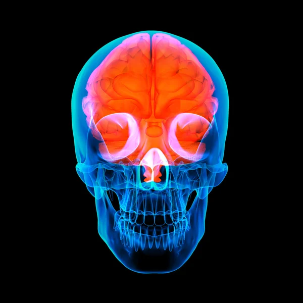 Czerwony ludzkiego mózgu x ray - widok z przodu — Zdjęcie stockowe