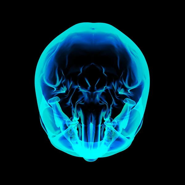 Isolierter menschlicher Röntgenschädel auf schwarzem Hintergrund - Draufsicht — Stockfoto
