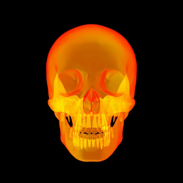 Isolated human x ray skull on black background - front view — Stock Photo, Image