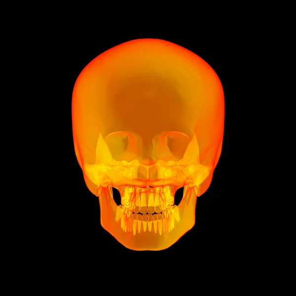 Isolated human x ray skull on black background - back view — Stock Photo, Image