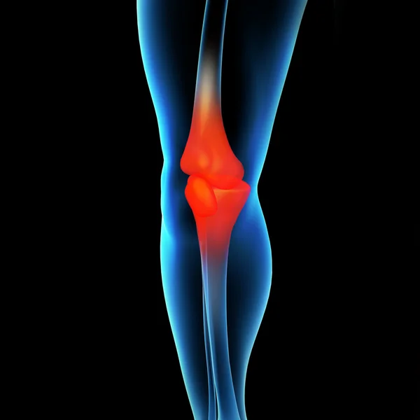 Dor no joelho humano com a anatomia de uma perna de esqueleto — Fotografia de Stock