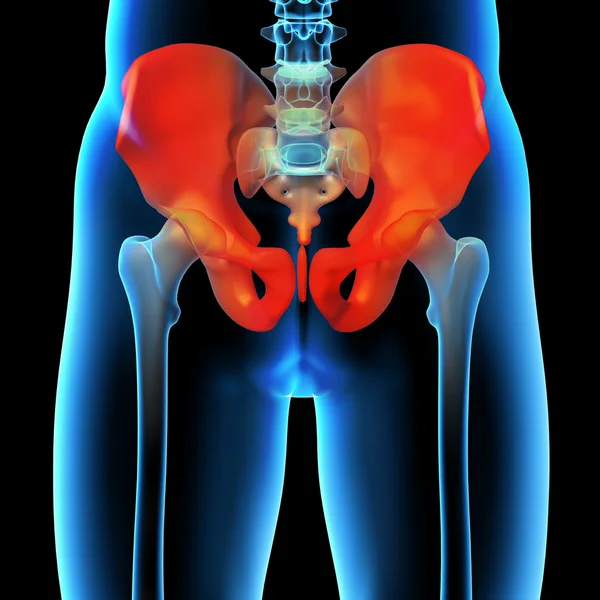 3D utsmält, medicinsk illustration av en smärtsam sacrum — Stockfoto
