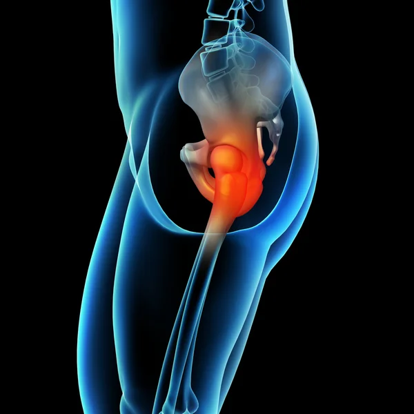 Painful hip joint — Stock Photo, Image