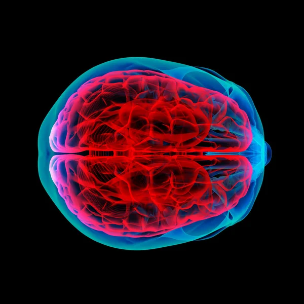 Menselijke hersenen X-ray - bovenaanzicht — Stockfoto