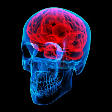 insan beyin x ışını - sağ ön görünüm