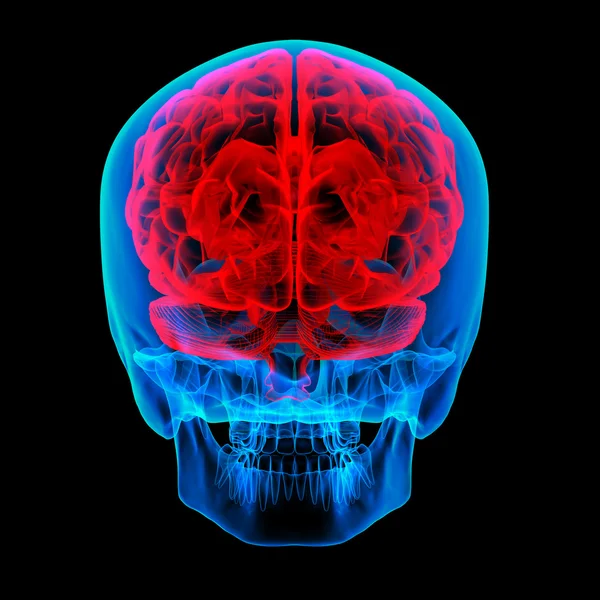 Mänsklig hjärnröntgen - bakifrån — Stockfoto