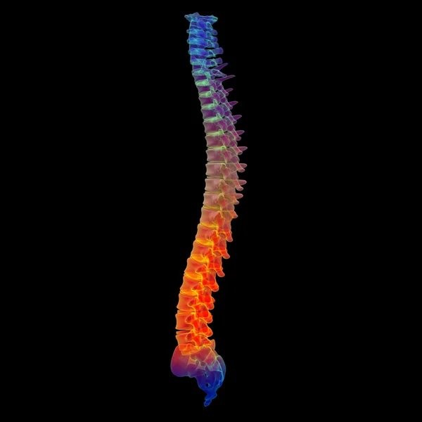 3D renderowania bolący kręgosłup — Zdjęcie stockowe